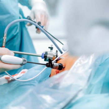 Minimally Invasive Surgeries Hospital Gudivada